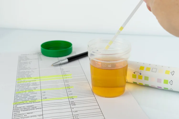 Urine Test at Home